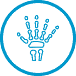 chirurgie de la main paris dr waitzenegger chirurgien de la main paris chirurgie de la main paris dr waitzenegger chirurgien de la main paris