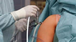 arthroscopie epaule paris docteur thomas waitzenegger chirurgie epaule chirurgie main chirurgie coude paris 16 longjumeau