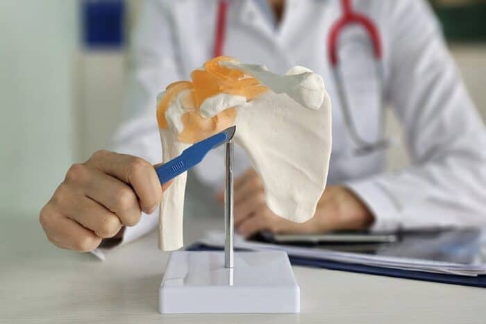 rupture coiffe rotateurs arret travail specialiste chirurgien epaule dr thomas waitzenegger paris