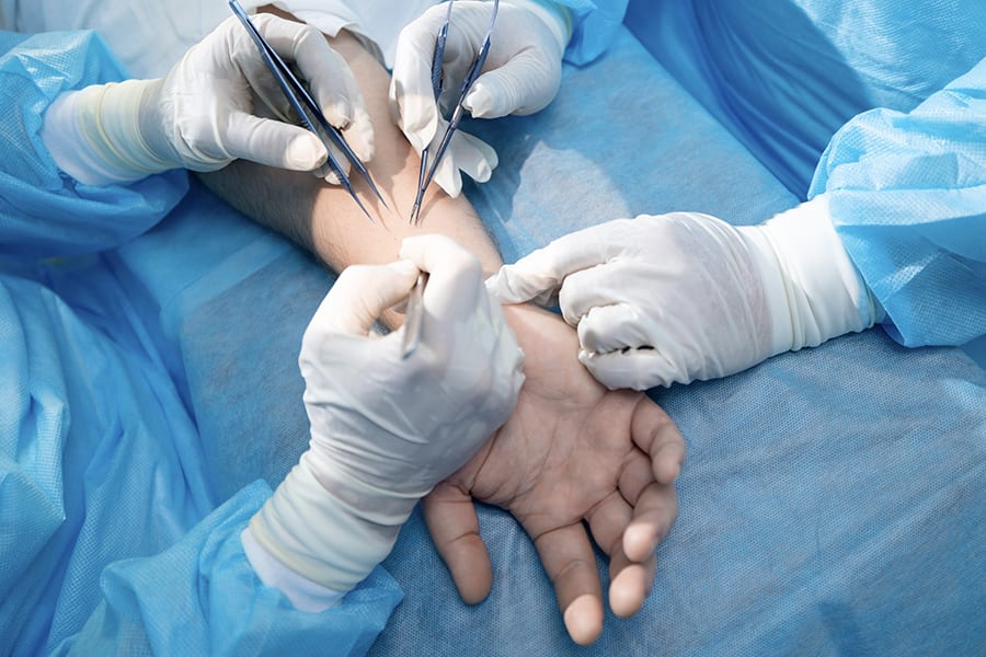 symptomes 15 jours operation canal carpien specialiste chirurgien epaule dr thomas waitzenegger paris